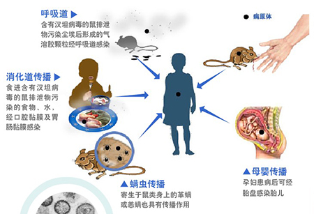 流行性出血熱你了解多少？